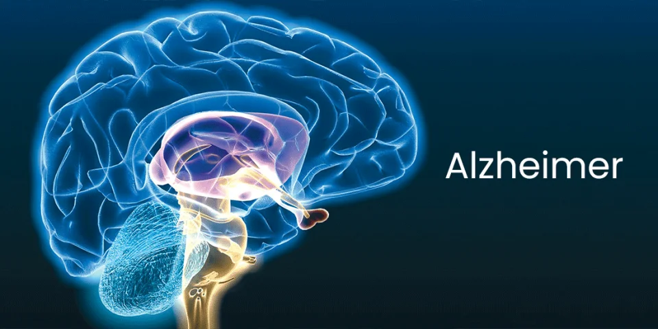 Scientific research into Alzheimer's disease diagnosis and treatment
